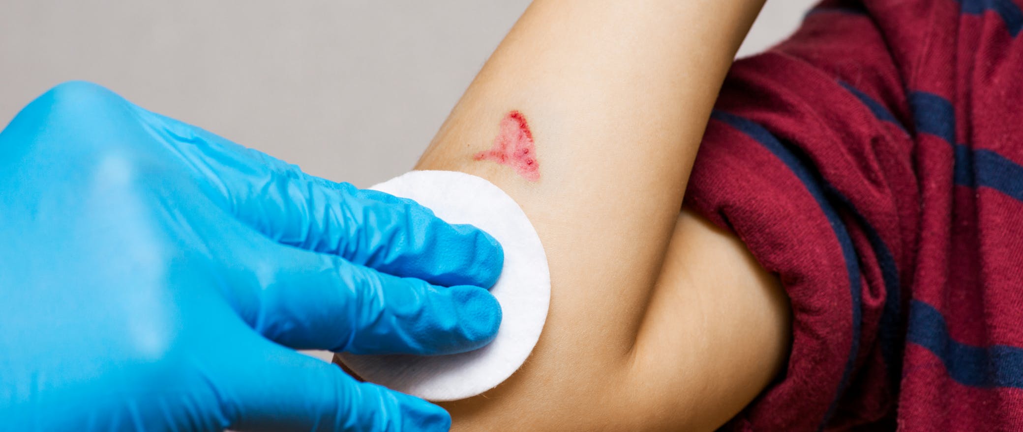 Become a First-Aid Pro: Instant Bleeding Control for Cuts and Wounds