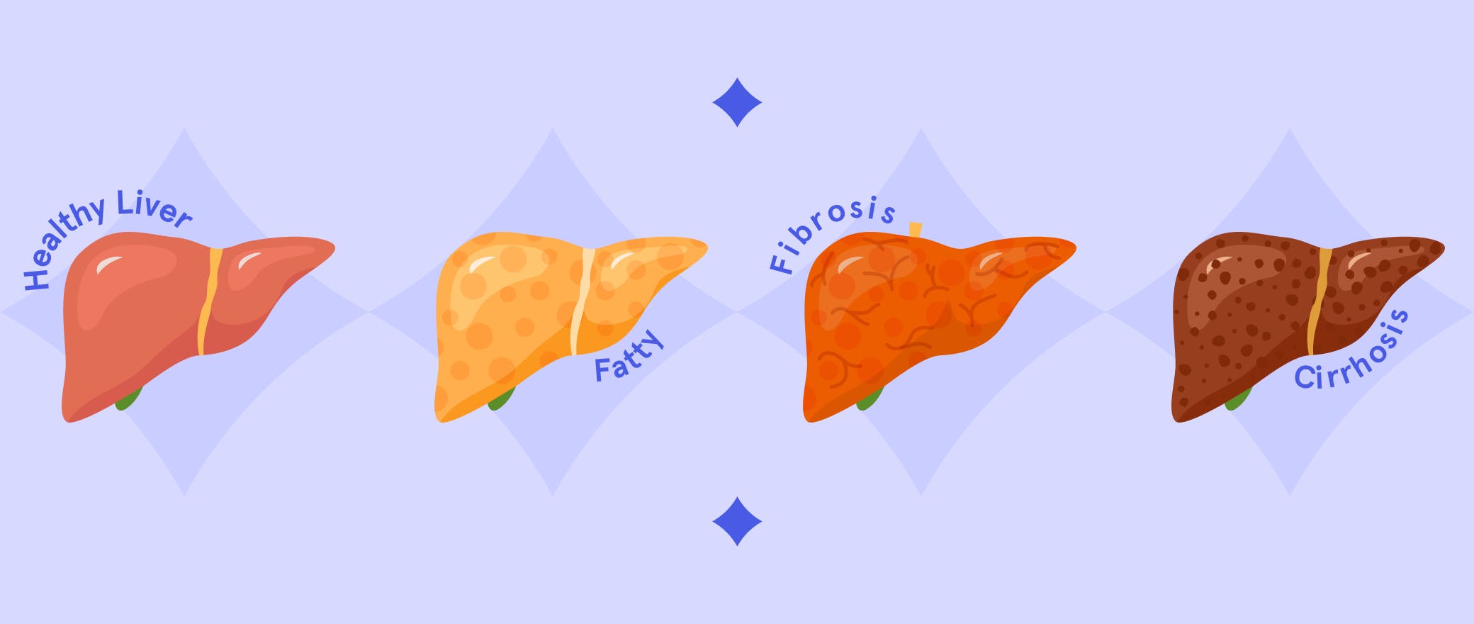 5 Things Doctors Want You To Know About Liver Cirrhosis